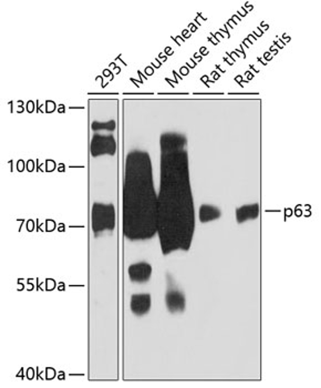 Western blot analysis of extracts of various cell lines, using p63 antibody (14-729) at 1:3000 dilution.<br/>Secondary antibody: HRP Goat Anti-Rabbit IgG (H+L) at 1:10000 dilution.<br/>Lysates/proteins: 25ug per lane.<br/>Blocking buffer: 3% nonfat dry milk in TBST.<br/>Detection: ECL Basic Kit.<br/>Exposure time: 30s.