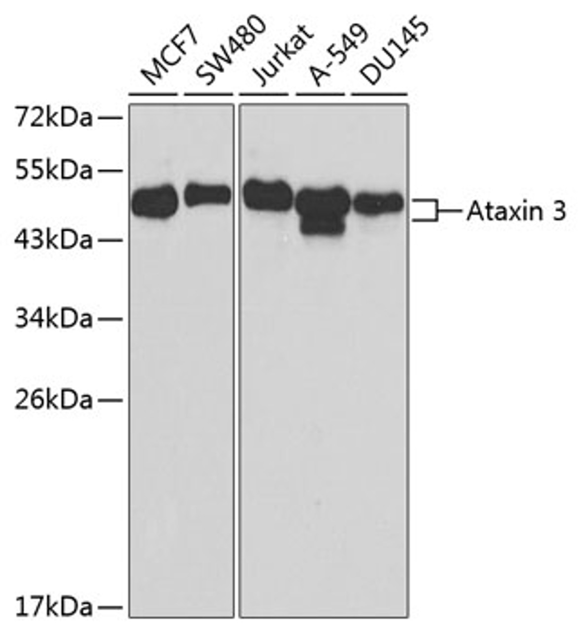 Western blot analysis of extracts of various cell lines, using Ataxin 3 antibody (14-732) at 1:1000 dilution.<br/>Secondary antibody: HRP Goat Anti-Rabbit IgG (H+L) at 1:10000 dilution.<br/>Lysates/proteins: 25ug per lane.<br/>Blocking buffer: 3% nonfat dry milk in TBST.