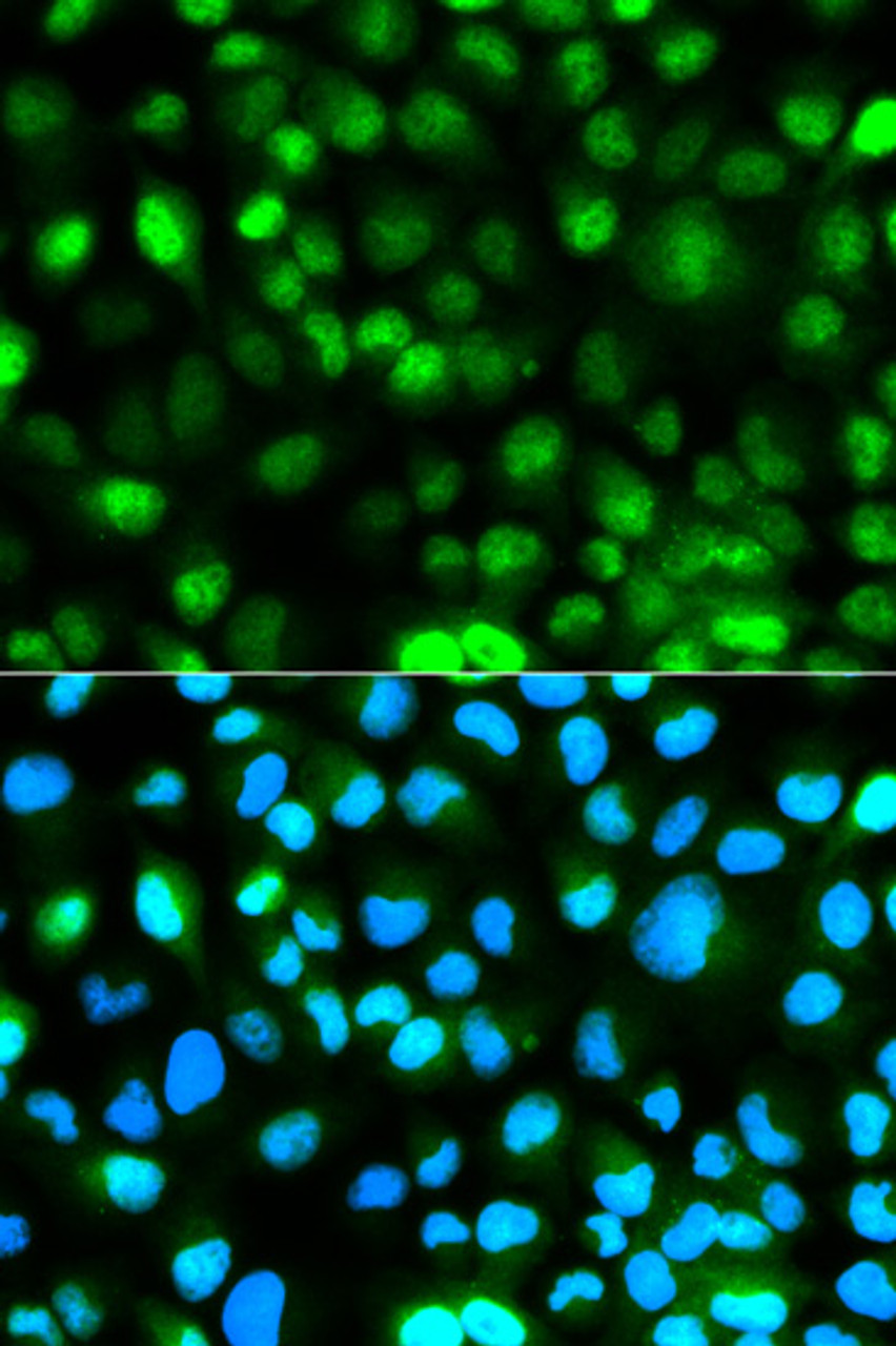 Immunofluorescence analysis of HeLa cells using Ataxin 3 antibody (14-732) . Blue: DAPI for nuclear staining.