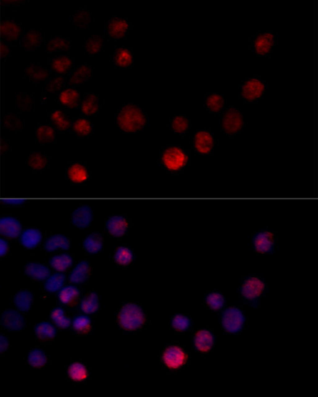 Immunofluorescence analysis of 293T cells using HNRNPH2 antibody (14-733) at dilution of 1:100 (40x lens) . Blue: DAPI for nuclear staining.