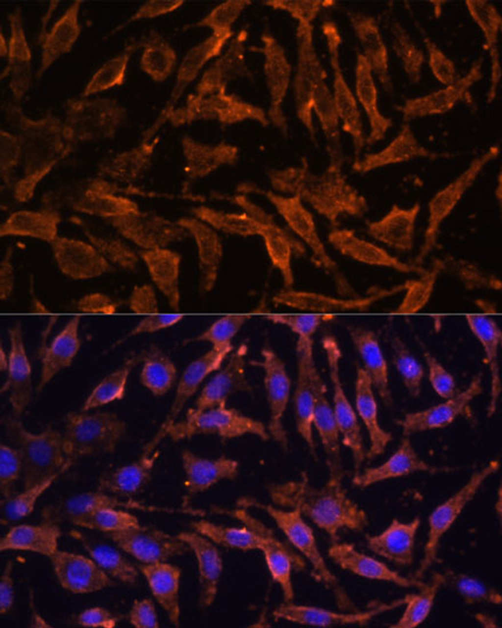 Immunofluorescence analysis of L929 cells using TNFRSF11A Polyclonal Antibody (14-735) at dilution of 1:100 (40x lens) . Blue: DAPI for nuclear staining.