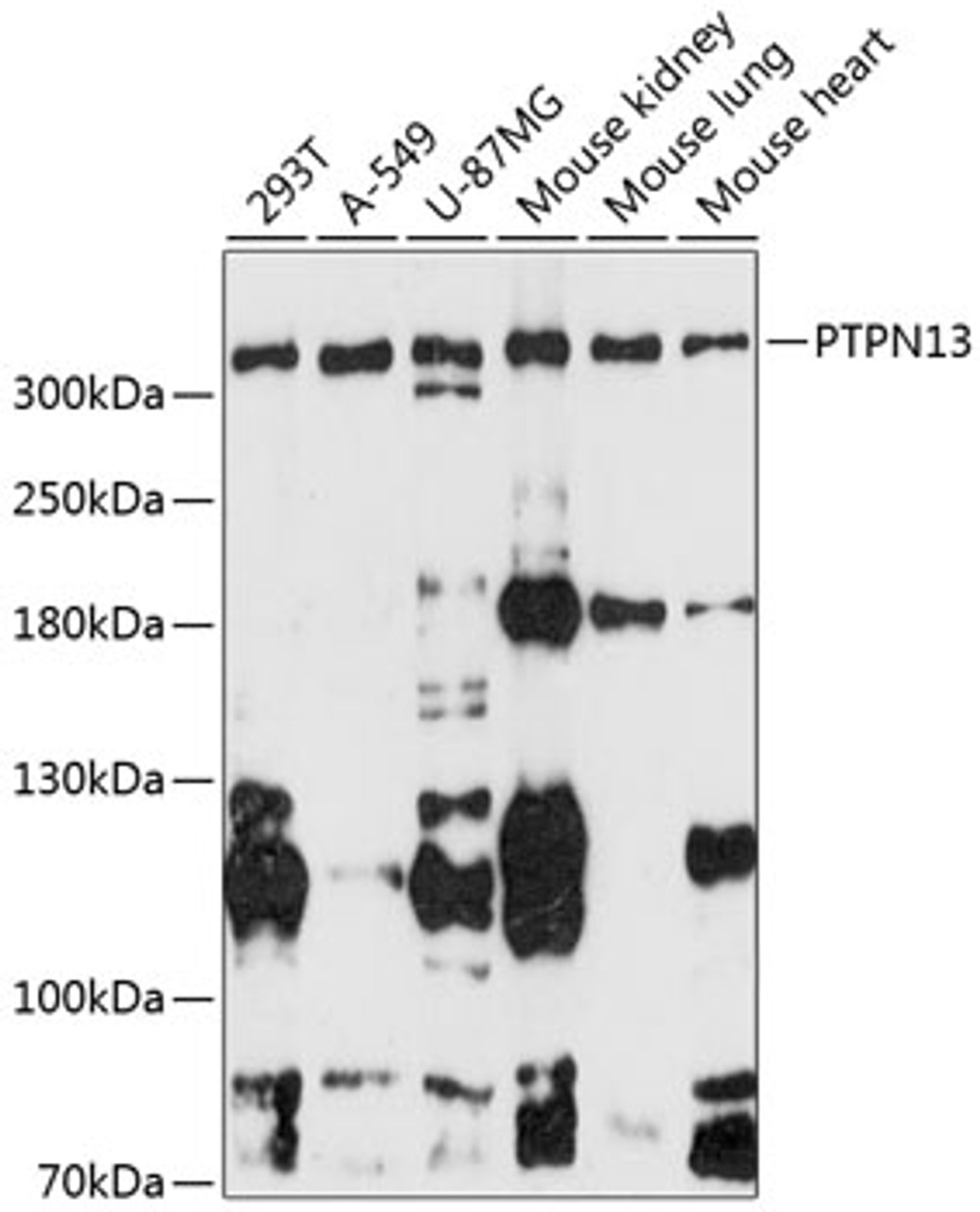 Western blot analysis of extracts of various cell lines, using PTPN13 antibody (14-741) at 1:3000 dilution._Secondary antibody: HRP Goat Anti-Rabbit IgG (H+L) at 1:10000 dilution._Lysates/proteins: 25ug per lane._Blocking buffer: 3% nonfat dry milk in TBST._Detection: ECL Enhanced Kit._Exposure time: 90s.