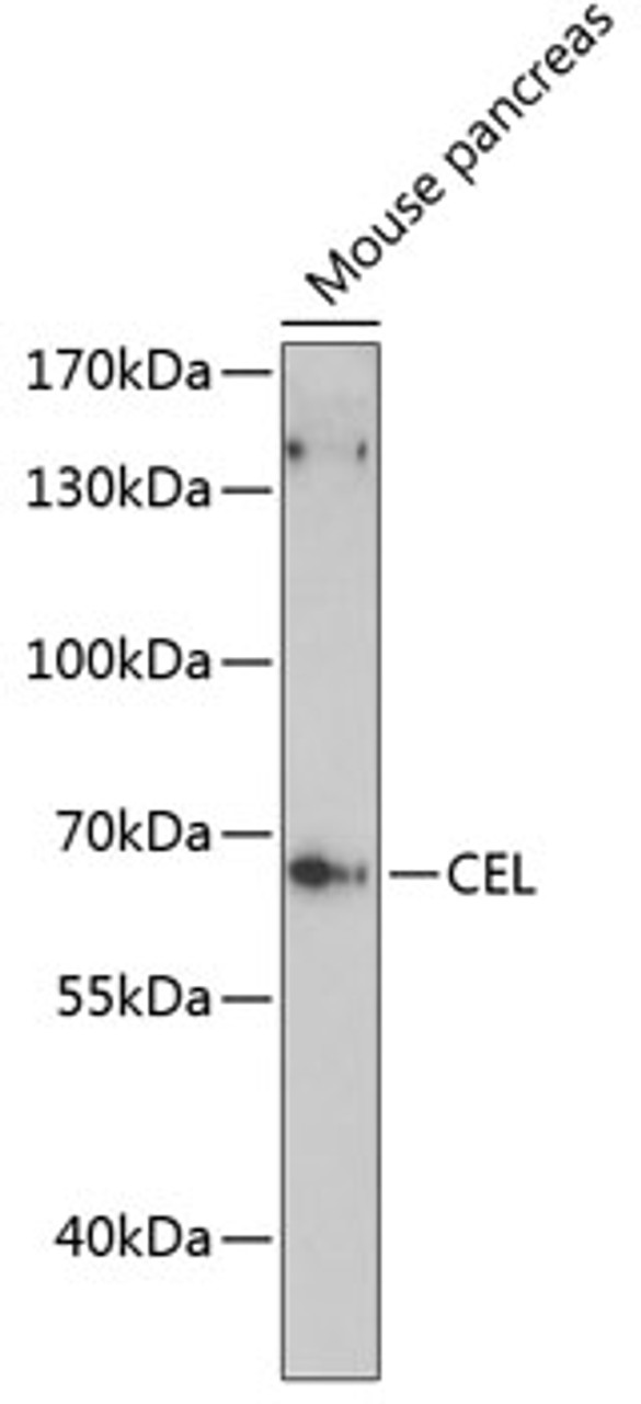 Western blot analysis of extracts of mouse pancreas, using CEL antibody (14-743) at 1:3000 dilution.<br/>Secondary antibody: HRP Goat Anti-Rabbit IgG (H+L) at 1:10000 dilution.<br/>Lysates/proteins: 25ug per lane.<br/>Blocking buffer: 3% nonfat dry milk in TBST.<br/>Detection: ECL Basic Kit.<br/>Exposure time: 90s.