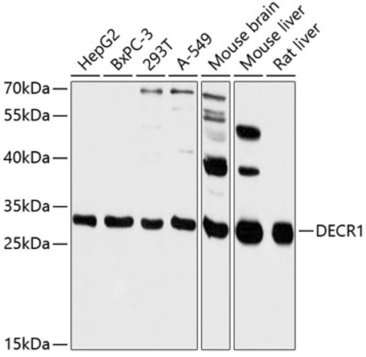 Western blot analysis of extracts of various cell lines, using DECR1 antibody (14-744) at 1:3000 dilution.<br/>Secondary antibody: HRP Goat Anti-Rabbit IgG (H+L) at 1:10000 dilution.<br/>Lysates/proteins: 25ug per lane.<br/>Blocking buffer: 3% nonfat dry milk in TBST.<br/>Detection: ECL Basic Kit.<br/>Exposure time: 30s.