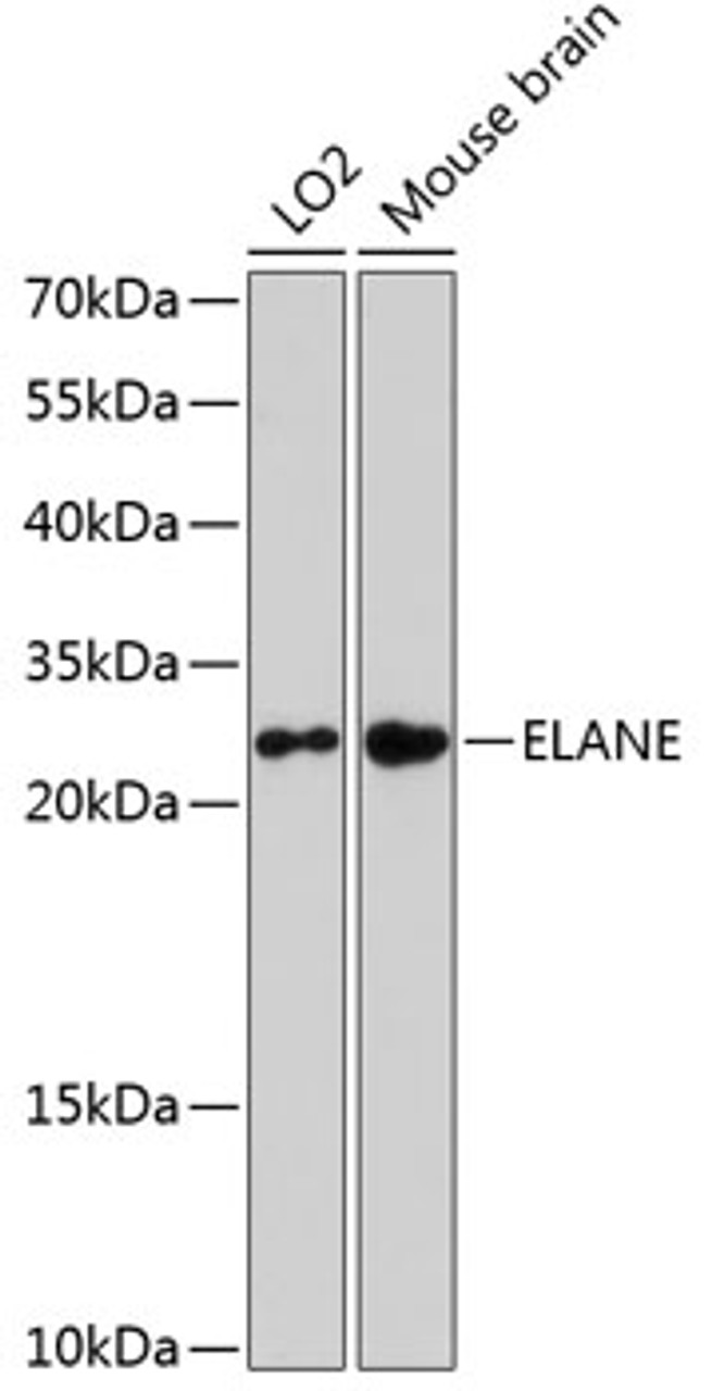 Western blot analysis of extracts of various cell lines, using ELANE antibody (14-745) at 1:3000 dilution.<br/>Secondary antibody: HRP Goat Anti-Rabbit IgG (H+L) at 1:10000 dilution.<br/>Lysates/proteins: 25ug per lane.<br/>Blocking buffer: 3% nonfat dry milk in TBST.<br/>Detection: ECL Enhanced Kit.<br/>Exposure time: 90s.