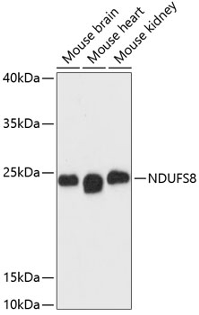 Western blot analysis of extracts of various cell lines, using NDUFS8 antibody (14-757) at 1:3000 dilution.<br/>Secondary antibody: HRP Goat Anti-Rabbit IgG (H+L) at 1:10000 dilution.<br/>Lysates/proteins: 25ug per lane.<br/>Blocking buffer: 3% nonfat dry milk in TBST.<br/>Detection: ECL Basic Kit.<br/>Exposure time: 90s.