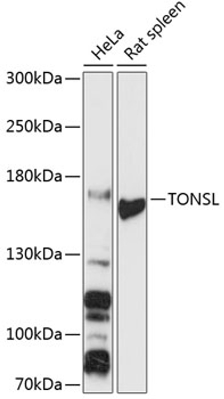 Western blot analysis of extracts of various cell lines, using TONSL antibody (14-758) at 1:3000 dilution.<br/>Secondary antibody: HRP Goat Anti-Rabbit IgG (H+L) at 1:10000 dilution.<br/>Lysates/proteins: 25ug per lane.<br/>Blocking buffer: 3% nonfat dry milk in TBST.<br/>Detection: ECL Basic Kit.<br/>Exposure time: 30s.