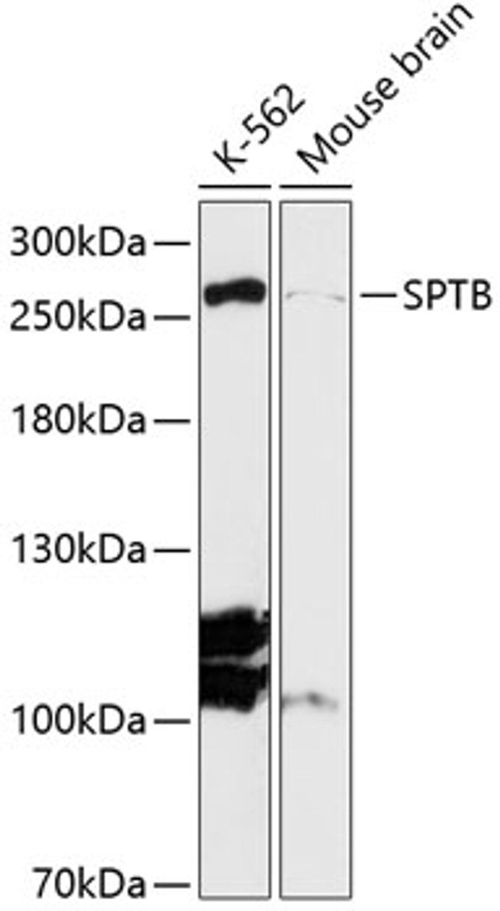 Western blot analysis of extracts of various cell lines, using SPTB antibody (14-765) at 1:3000 dilution.<br/>Secondary antibody: HRP Goat Anti-Rabbit IgG (H+L) at 1:10000 dilution.<br/>Lysates/proteins: 25ug per lane.<br/>Blocking buffer: 3% nonfat dry milk in TBST.<br/>Detection: ECL Enhanced Kit.<br/>Exposure time: 90s.