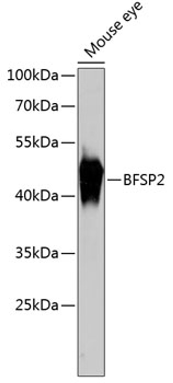 Western blot analysis of extracts of mouse eye, using BFSP2 antibody (14-769) at 1:3000 dilution.<br/>Secondary antibody: HRP Goat Anti-Rabbit IgG (H+L) at 1:10000 dilution.<br/>Lysates/proteins: 25ug per lane.<br/>Blocking buffer: 3% nonfat dry milk in TBST.<br/>Detection: ECL Basic Kit.<br/>Exposure time: 5s.