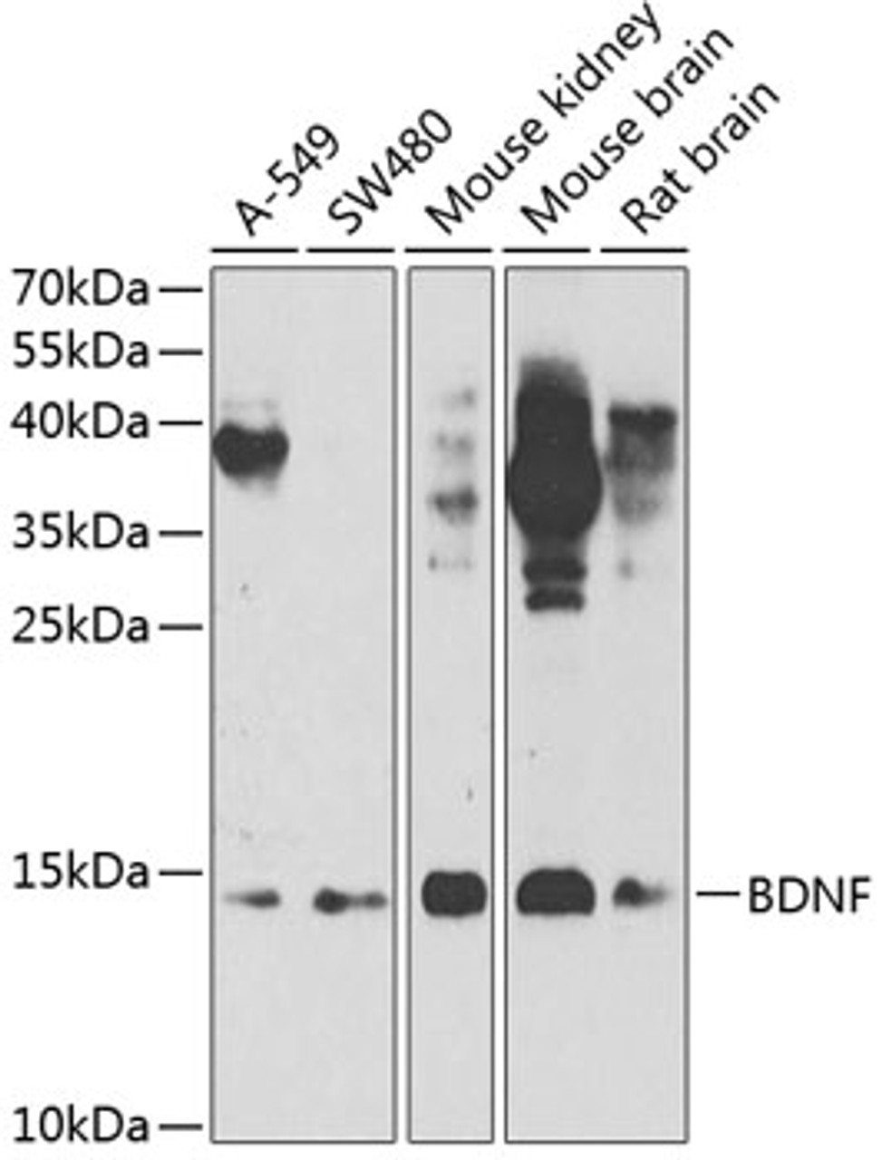 Western blot analysis of extracts of various cell lines, using BDNF antibody (14-776) at 1:1000 dilution.<br/>Secondary antibody: HRP Goat Anti-Rabbit IgG (H+L) at 1:10000 dilution.<br/>Lysates/proteins: 25ug per lane.<br/>Blocking buffer: 3% nonfat dry milk in TBST.<br/>Detection: ECL Enhanced Kit.<br/>Exposure time: 90s.