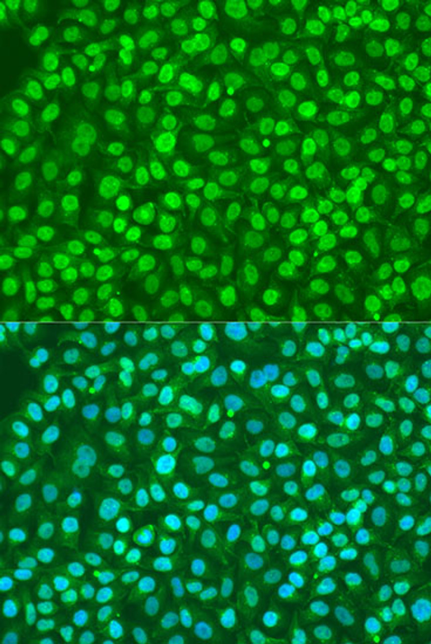 Immunofluorescence analysis of U2OS cells using BDNF antibody (14-776) at dilution of 1:100. Blue: DAPI for nuclear staining.