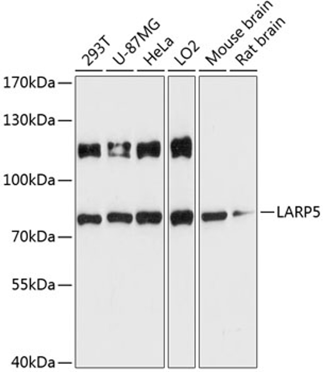 Western blot analysis of extracts of various cell lines, using LARP5 antibody (14-782) at 1:3000 dilution.<br/>Secondary antibody: HRP Goat Anti-Rabbit IgG (H+L) at 1:10000 dilution.<br/>Lysates/proteins: 25ug per lane.<br/>Blocking buffer: 3% nonfat dry milk in TBST.<br/>Detection: ECL Basic Kit.<br/>Exposure time: 90s.