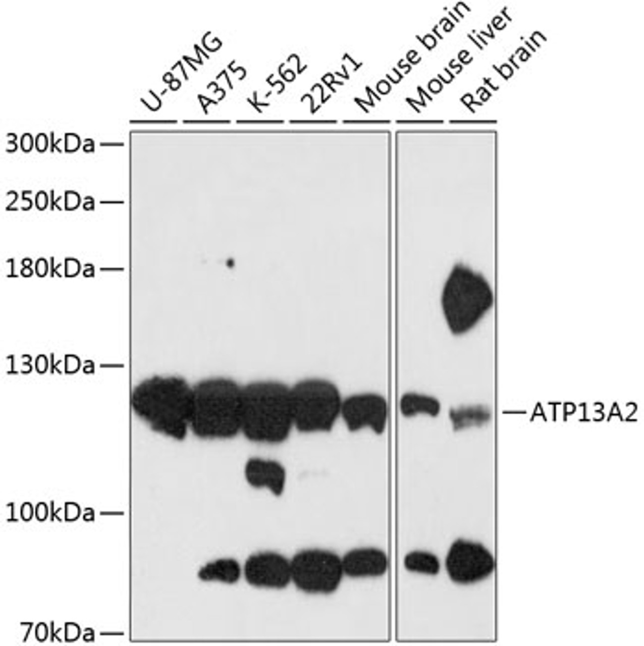 Western blot analysis of extracts of various cell lines, using ATP13A2 antibody (14-785) at 1:3000 dilution.<br/>Secondary antibody: HRP Goat Anti-Rabbit IgG (H+L) at 1:10000 dilution.<br/>Lysates/proteins: 25ug per lane.<br/>Blocking buffer: 3% nonfat dry milk in TBST.<br/>Detection: ECL Basic Kit.<br/>Exposure time: 30s.