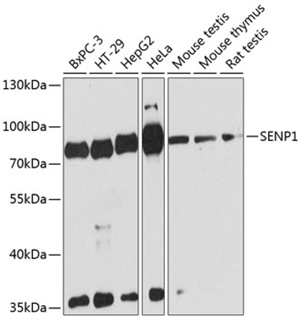 Western blot analysis of extracts of various cell lines, using SENP1 antibody (14-787) at 1:3000 dilution.<br/>Secondary antibody: HRP Goat Anti-Rabbit IgG (H+L) at 1:10000 dilution.<br/>Lysates/proteins: 25ug per lane.<br/>Blocking buffer: 3% nonfat dry milk in TBST.<br/>Detection: ECL Basic Kit.<br/>Exposure time: 90s.