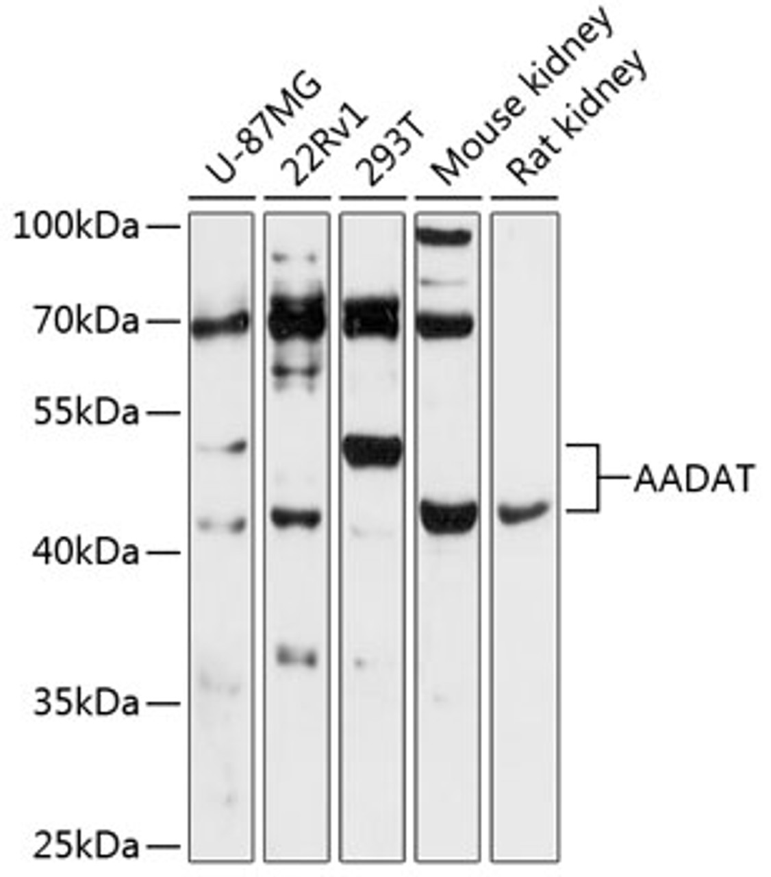 Western blot analysis of extracts of various cell lines, using AADAT antibody (14-788) at 1:3000 dilution.<br/>Secondary antibody: HRP Goat Anti-Rabbit IgG (H+L) at 1:10000 dilution.<br/>Lysates/proteins: 25ug per lane.<br/>Blocking buffer: 3% nonfat dry milk in TBST.<br/>Detection: ECL Basic Kit.<br/>Exposure time: 90s.