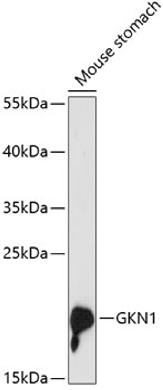 Western blot analysis of extracts of mouse stomach, using GKN1 antibody (14-797) at 1:3000 dilution.<br/>Secondary antibody: HRP Goat Anti-Rabbit IgG (H+L) at 1:10000 dilution.<br/>Lysates/proteins: 25ug per lane.<br/>Blocking buffer: 3% nonfat dry milk in TBST.<br/>Detection: ECL Basic Kit.<br/>Exposure time: 90s.