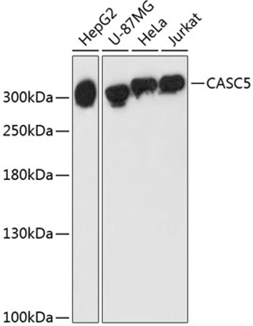 Western blot analysis of extracts of various cell lines, using CASC5 antibody (14-798) at 1:3000 dilution.<br/>Secondary antibody: HRP Goat Anti-Rabbit IgG (H+L) at 1:10000 dilution.<br/>Lysates/proteins: 25ug per lane.<br/>Blocking buffer: 3% nonfat dry milk in TBST.<br/>Detection: ECL Enhanced Kit.<br/>Exposure time: 90s.