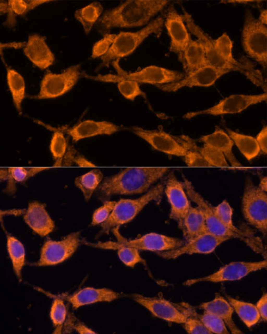 Immunofluorescence analysis of HeLa cells using USP36 Polyclonal Antibody (14-799) at dilution of 1:100 (40x lens) . Blue: DAPI for nuclear staining.