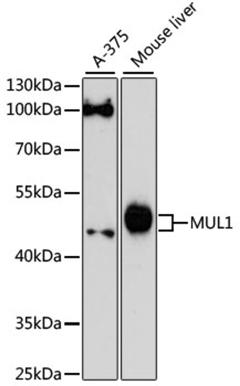 Western blot analysis of extracts of various cell lines, using MUL1 antibody (14-804) at 1:3000 dilution.<br/>Secondary antibody: HRP Goat Anti-Rabbit IgG (H+L) at 1:10000 dilution.<br/>Lysates/proteins: 25ug per lane.<br/>Blocking buffer: 3% nonfat dry milk in TBST.<br/>Detection: ECL Enhanced Kit.<br/>Exposure time: 90s.