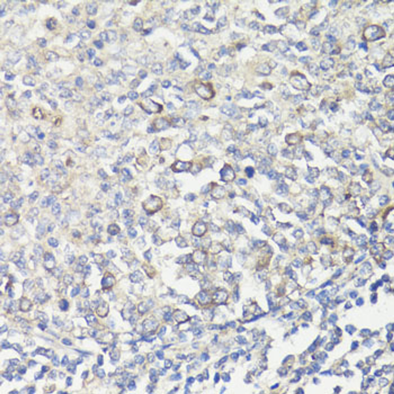 Immunohistochemistry of paraffin-embedded human tonsil using MUL1 antibody (14-804) at dilution of 1:100 (40x lens) .