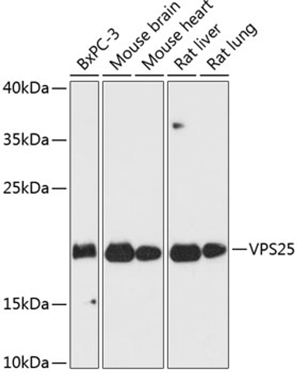 Western blot analysis of extracts of various cell lines, using VPS25 antibody (14-809) at 1:3000 dilution.<br/>Secondary antibody: HRP Goat Anti-Rabbit IgG (H+L) at 1:10000 dilution.<br/>Lysates/proteins: 25ug per lane.<br/>Blocking buffer: 3% nonfat dry milk in TBST.<br/>Detection: ECL Basic Kit.<br/>Exposure time: 30s.