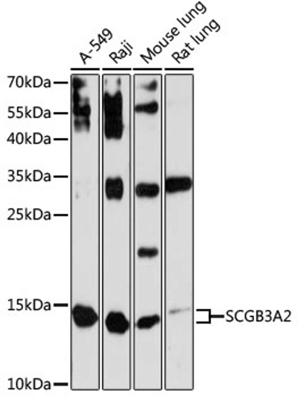 Western blot analysis of extracts of various cell lines, using SCGB3A2 antibody (14-811) at 1:3000 dilution.<br/>Secondary antibody: HRP Goat Anti-Rabbit IgG (H+L) at 1:10000 dilution.<br/>Lysates/proteins: 25ug per lane.<br/>Blocking buffer: 3% nonfat dry milk in TBST.<br/>Detection: ECL Enhanced Kit.<br/>Exposure time: 90s.