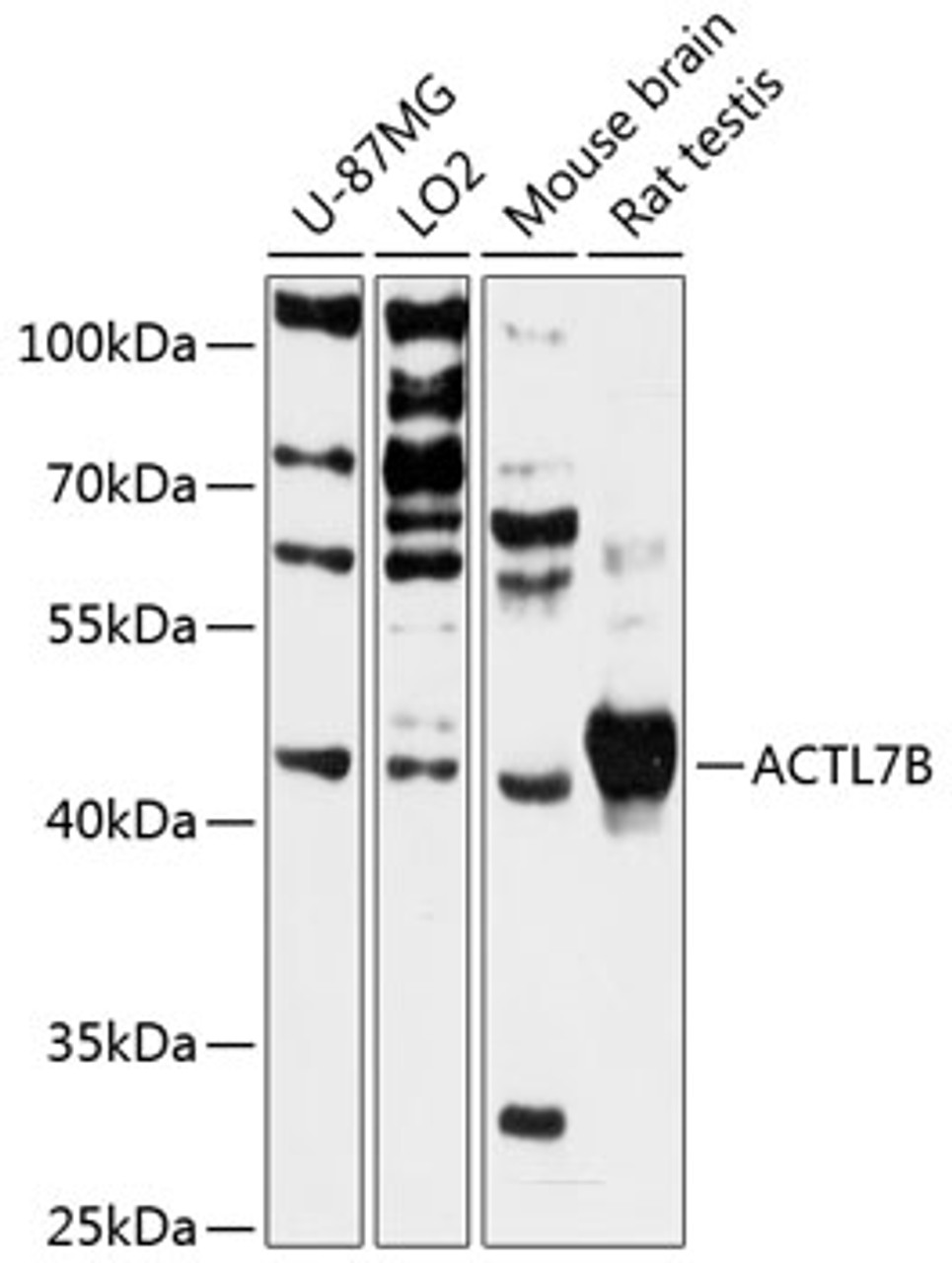Western blot analysis of extracts of various cell lines, using ACTL7B antibody (14-818) at 1:3000 dilution.<br/>Secondary antibody: HRP Goat Anti-Rabbit IgG (H+L) at 1:10000 dilution.<br/>Lysates/proteins: 25ug per lane.<br/>Blocking buffer: 3% nonfat dry milk in TBST.<br/>Detection: ECL Basic Kit.<br/>Exposure time: 60s.