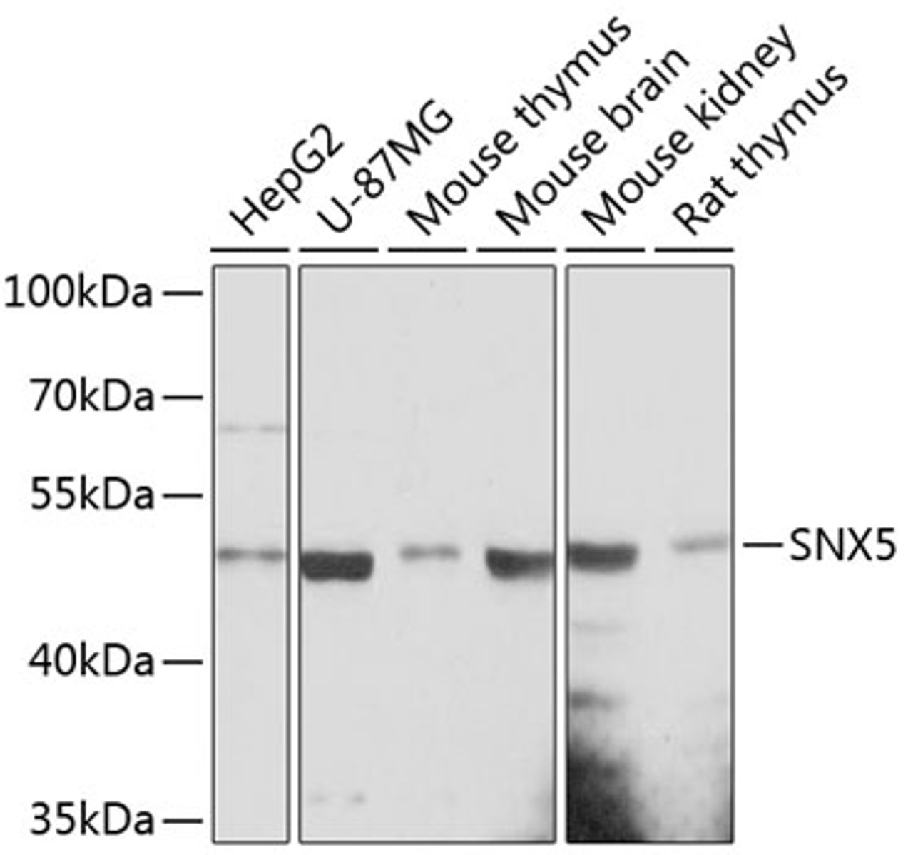 Western blot analysis of extracts of various cell lines, using SNX5 antibody (14-826) at 1:3000 dilution.<br/>Secondary antibody: HRP Goat Anti-Rabbit IgG (H+L) at 1:10000 dilution.<br/>Lysates/proteins: 25ug per lane.<br/>Blocking buffer: 3% nonfat dry milk in TBST.<br/>Detection: ECL Basic Kit.<br/>Exposure time: 90s.