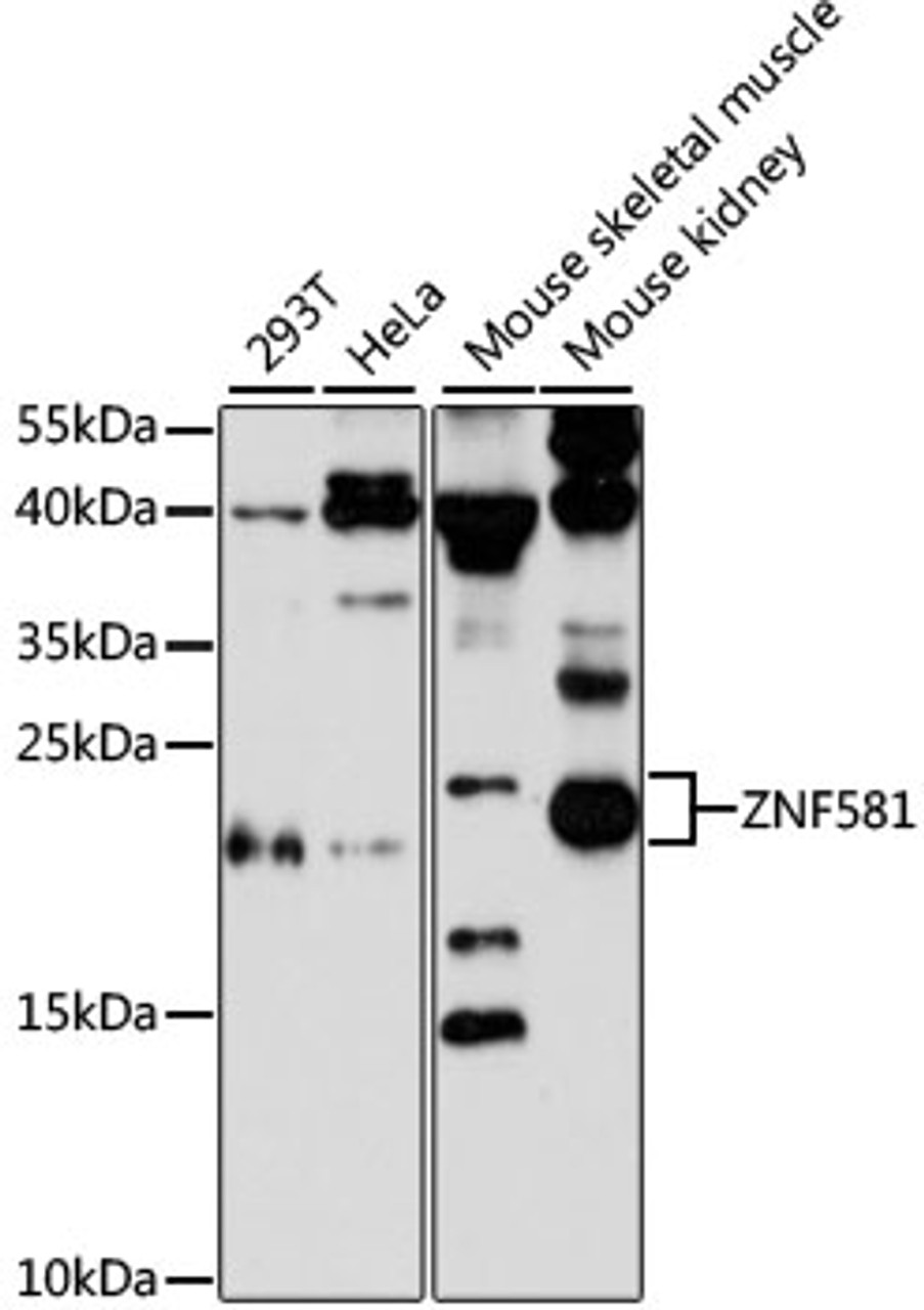 Western blot analysis of extracts of various cell lines, using ZNF581 antibody (14-828) at 1:3000 dilution.<br/>Secondary antibody: HRP Goat Anti-Rabbit IgG (H+L) at 1:10000 dilution.<br/>Lysates/proteins: 25ug per lane.<br/>Blocking buffer: 3% nonfat dry milk in TBST.<br/>Detection: ECL Enhanced Kit.<br/>Exposure time: 90s.