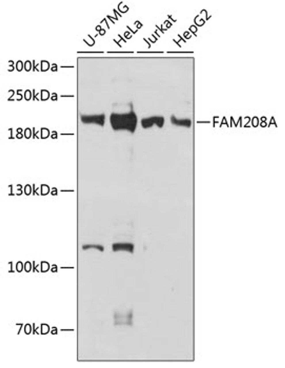 Western blot analysis of extracts of various cell lines, using FAM208A antibody (14-839) at 1:3000 dilution.<br/>Secondary antibody: HRP Goat Anti-Rabbit IgG (H+L) at 1:10000 dilution.<br/>Lysates/proteins: 25ug per lane.<br/>Blocking buffer: 3% nonfat dry milk in TBST.<br/>Detection: ECL Basic Kit.<br/>Exposure time: 30s.