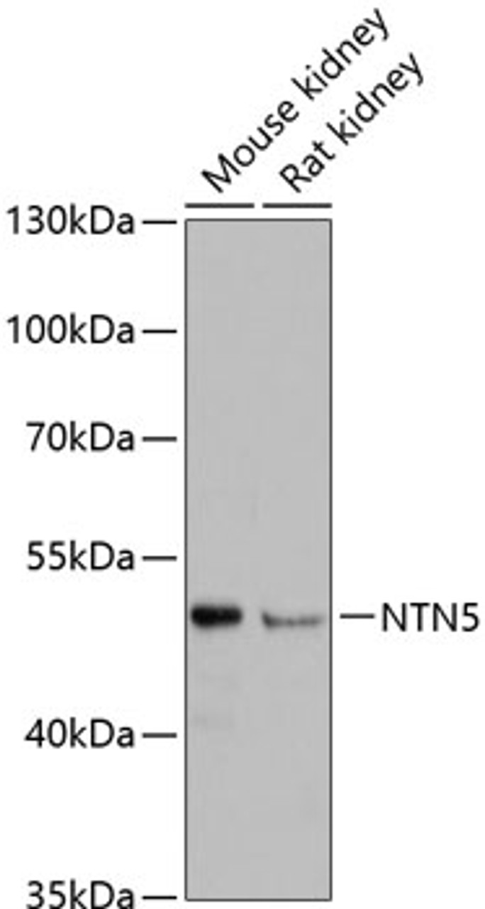 Western blot analysis of extracts of various cell lines, using NTN5 antibody (14-848) at 1:3000 dilution.<br/>Secondary antibody: HRP Goat Anti-Rabbit IgG (H+L) at 1:10000 dilution.<br/>Lysates/proteins: 25ug per lane.<br/>Blocking buffer: 3% nonfat dry milk in TBST.<br/>Detection: ECL Basic Kit.<br/>Exposure time: 90s.