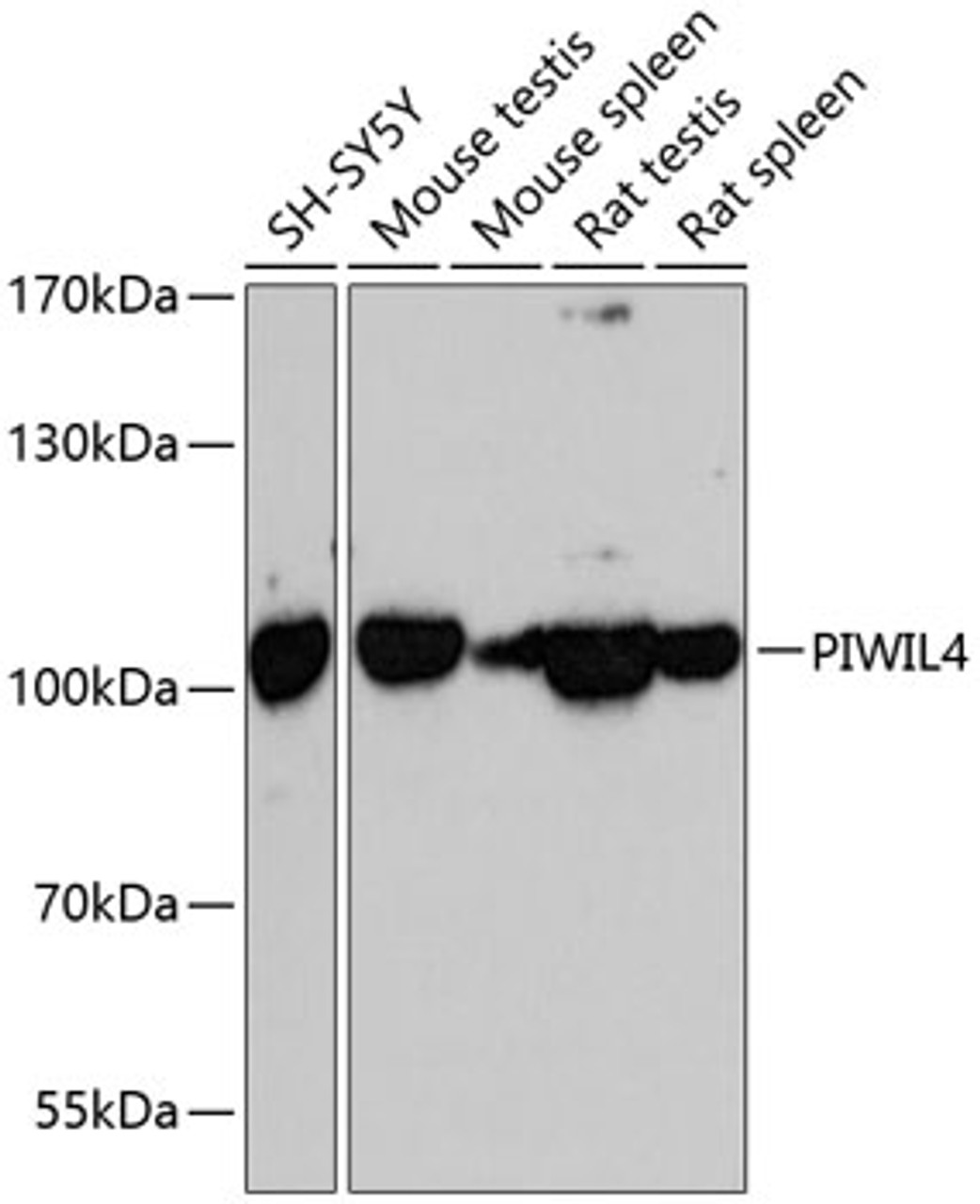 Western blot analysis of extracts of various cell lines, using PIWIL4 antibody (14-849) at 1:3000 dilution.<br/>Secondary antibody: HRP Goat Anti-Rabbit IgG (H+L) at 1:10000 dilution.<br/>Lysates/proteins: 25ug per lane.<br/>Blocking buffer: 3% nonfat dry milk in TBST.<br/>Detection: ECL Basic Kit.<br/>Exposure time: 90s.