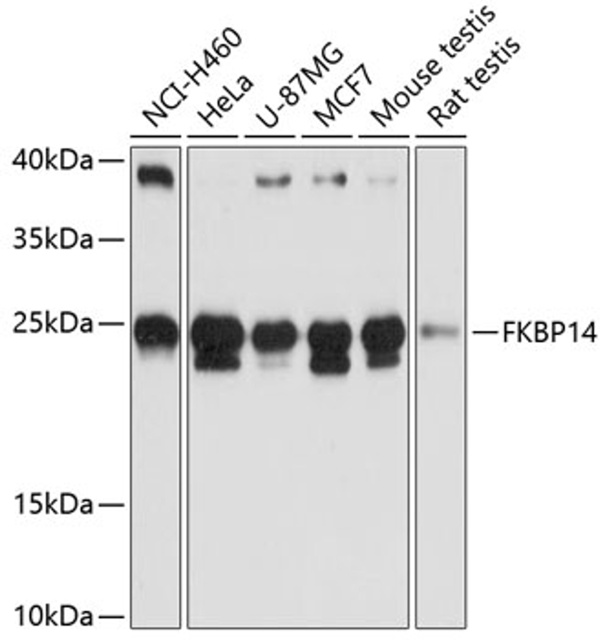 Western blot analysis of extracts of various cell lines, using FKBP14 antibody (14-857) at 1:3000 dilution.<br/>Secondary antibody: HRP Goat Anti-Rabbit IgG (H+L) at 1:10000 dilution.<br/>Lysates/proteins: 25ug per lane.<br/>Blocking buffer: 3% nonfat dry milk in TBST.<br/>Detection: ECL Basic Kit.<br/>Exposure time: 10s.