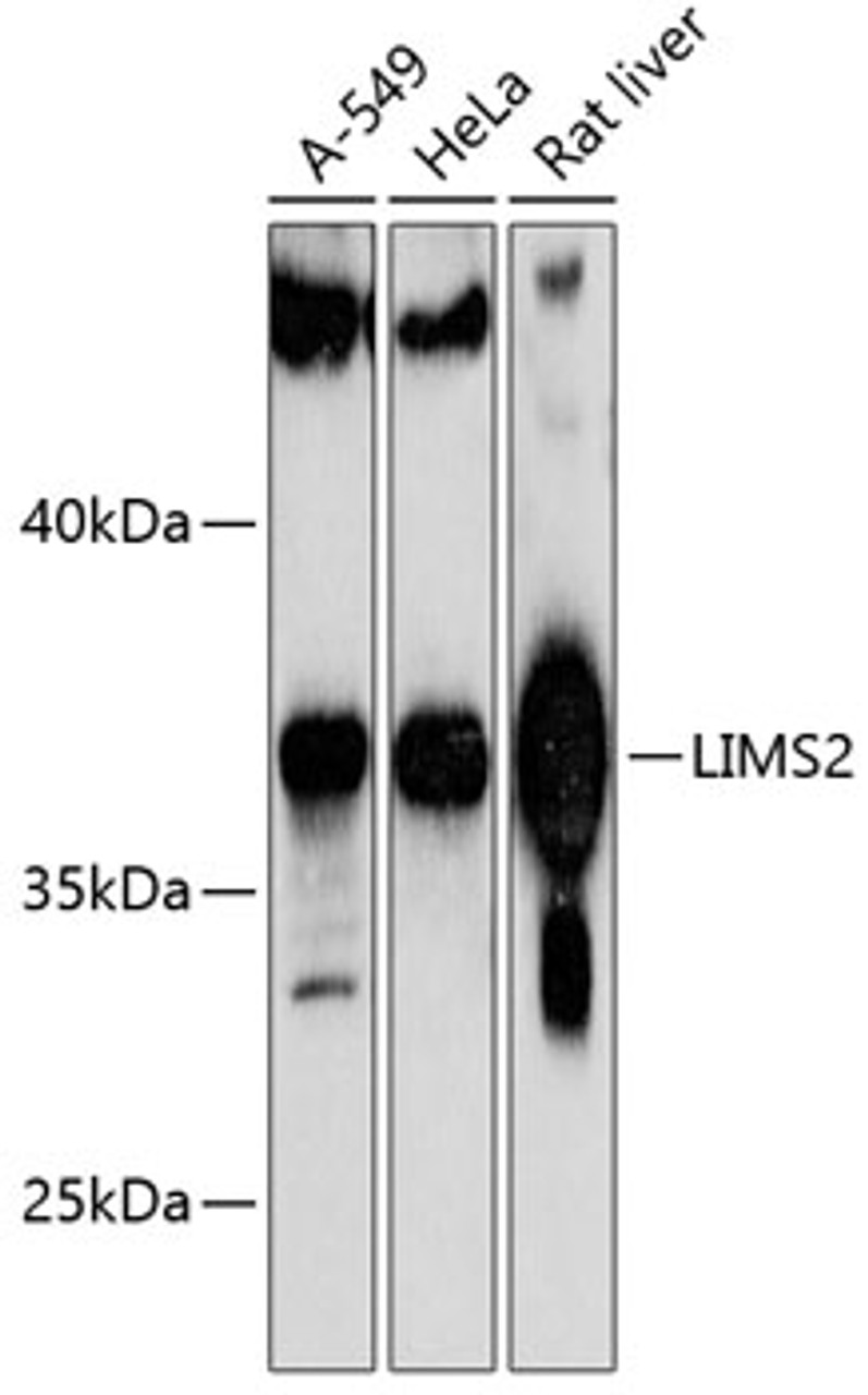 Western blot analysis of extracts of various cell lines, using LIMS2 antibody (14-859) at 1:1000 dilution.<br/>Secondary antibody: HRP Goat Anti-Rabbit IgG (H+L) at 1:10000 dilution.<br/>Lysates/proteins: 25ug per lane.<br/>Blocking buffer: 3% nonfat dry milk in TBST.<br/>Detection: ECL Basic Kit.<br/>Exposure time: 60s.