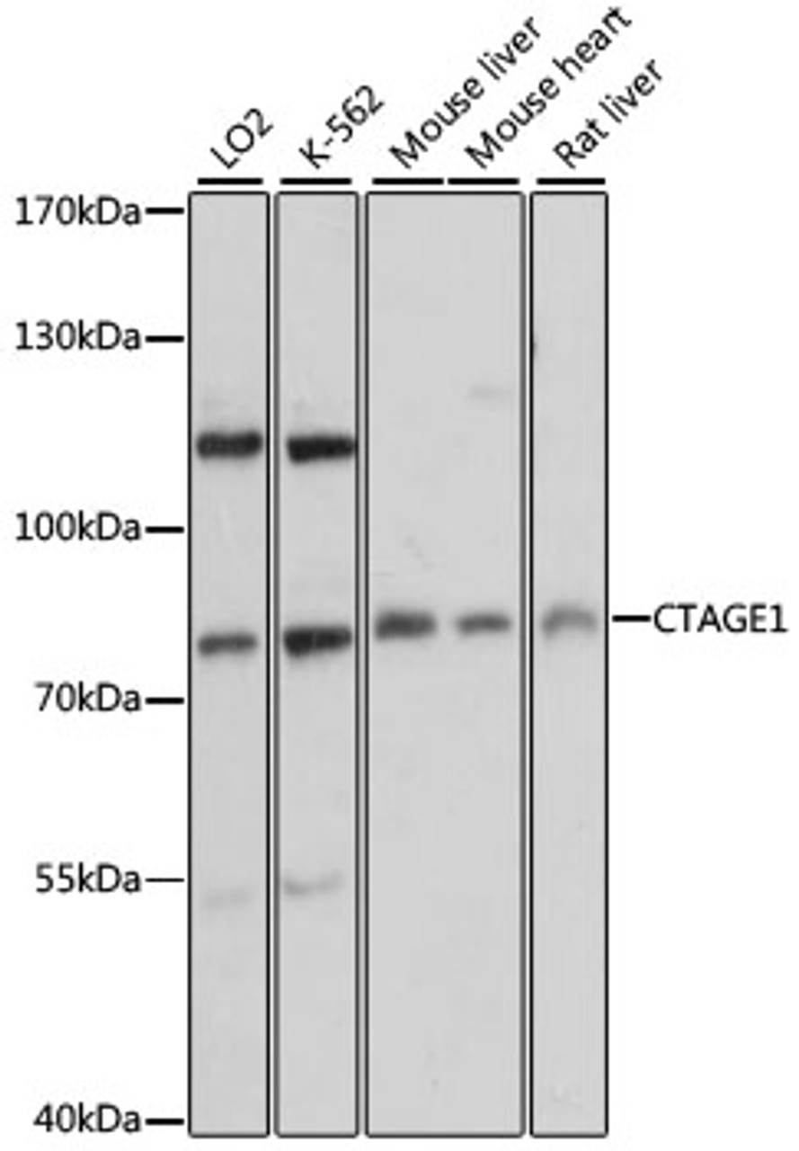 Western blot analysis of extracts of various cell lines, using CTAGE1 antibody (14-861) at 1:3000 dilution.<br/>Secondary antibody: HRP Goat Anti-Rabbit IgG (H+L) at 1:10000 dilution.<br/>Lysates/proteins: 25ug per lane.<br/>Blocking buffer: 3% nonfat dry milk in TBST.<br/>Detection: ECL Basic Kit.<br/>Exposure time: 1s.