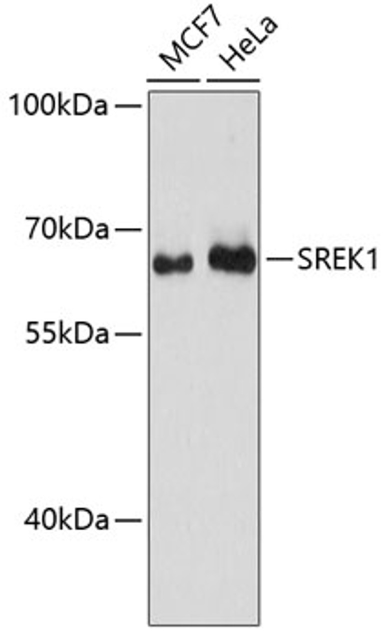 Western blot analysis of extracts of various cell lines, using SREK1 antibody (14-865) at 1:3000 dilution.<br/>Secondary antibody: HRP Goat Anti-Rabbit IgG (H+L) at 1:10000 dilution.<br/>Lysates/proteins: 25ug per lane.<br/>Blocking buffer: 3% nonfat dry milk in TBST.<br/>Detection: ECL Basic Kit.<br/>Exposure time: 90s.