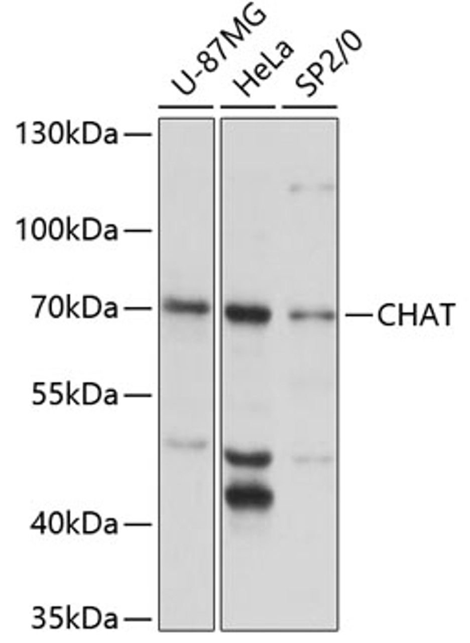 Western blot analysis of extracts of various cell lines, using CHAT antibody (14-868) at 1:3000 dilution.<br/>Secondary antibody: HRP Goat Anti-Rabbit IgG (H+L) at 1:10000 dilution.<br/>Lysates/proteins: 25ug per lane.<br/>Blocking buffer: 3% nonfat dry milk in TBST.<br/>Detection: ECL Basic Kit.<br/>Exposure time: 10s.