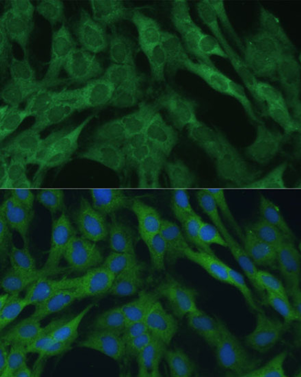 Immunofluorescence analysis of C6 cells using IDH1 Polyclonal Antibody (14-869) at dilution of 1:100 (40x lens) . Blue: DAPI for nuclear staining.