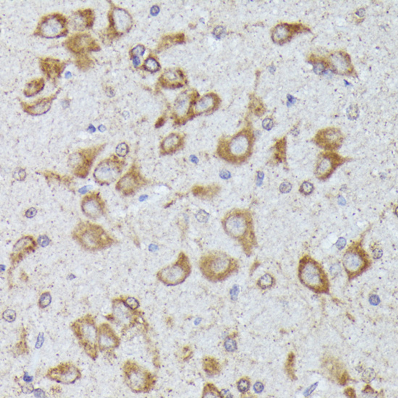 Immunohistochemistry of paraffin-embedded rat brain using TBCB antibody (14-870) at dilution of 1:100 (40x lens) .