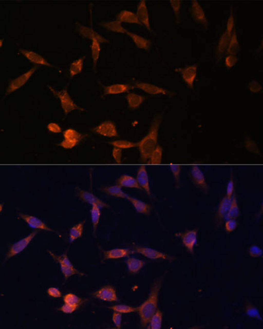 Immunofluorescence analysis of NIH-3T3 cells using UMPS Polyclonal Antibody (14-872) at dilution of 1:100 (40x lens) . Blue: DAPI for nuclear staining.