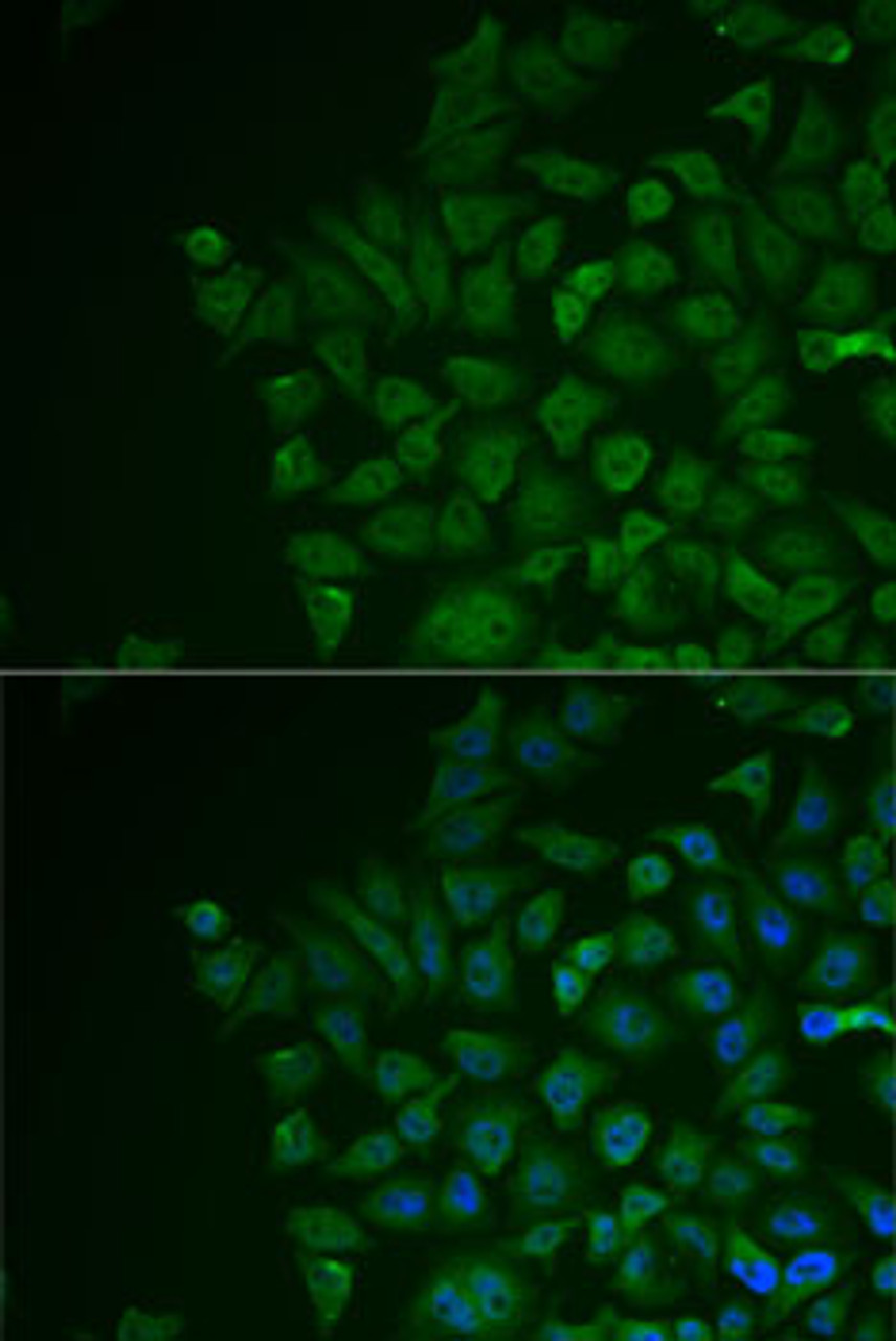 Immunofluorescence analysis of MCF7 cells using LRAT antibody (14-873) . Blue: DAPI for nuclear staining.