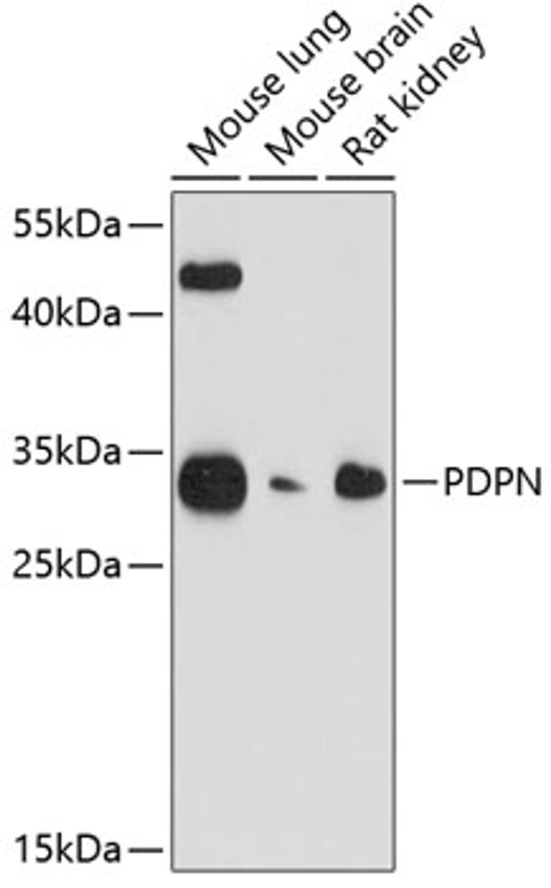 Western blot analysis of extracts of various cell lines, using PDPN antibody (14-876) at 1:1000 dilution.<br/>Secondary antibody: HRP Goat Anti-Rabbit IgG (H+L) at 1:10000 dilution.<br/>Lysates/proteins: 25ug per lane.<br/>Blocking buffer: 3% nonfat dry milk in TBST.<br/>Detection: ECL Basic Kit.<br/>Exposure time: 90s.