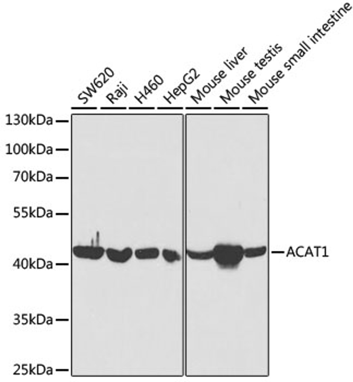 Western blot analysis of extracts of various cell lines, using ACAT1 antibody (14-882) at 1:5000 dilution.<br/>Secondary antibody: HRP Goat Anti-Rabbit IgG (H+L) at 1:10000 dilution.<br/>Lysates/proteins: 25ug per lane.<br/>Blocking buffer: 3% nonfat dry milk in TBST.<br/>Detection: ECL Basic Kit.<br/>Exposure time: 10s.