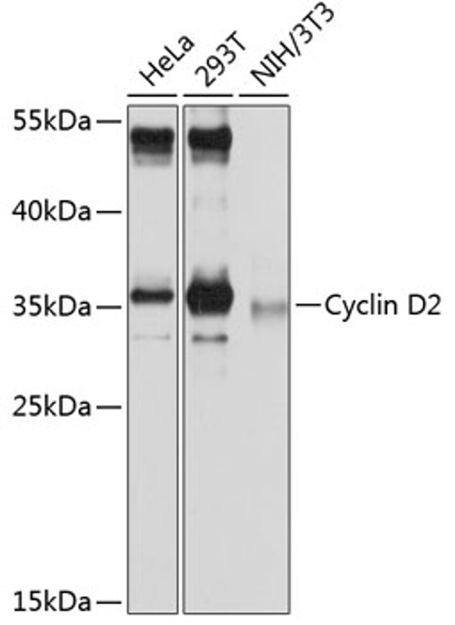 Western blot analysis of extracts of various cell lines, using Cyclin D2 antibody (14-888) at 1:1000 dilution.<br/>Secondary antibody: HRP Goat Anti-Rabbit IgG (H+L) at 1:10000 dilution.<br/>Lysates/proteins: 25ug per lane.<br/>Blocking buffer: 3% nonfat dry milk in TBST.<br/>Detection: ECL Basic Kit.<br/>Exposure time: 30s.