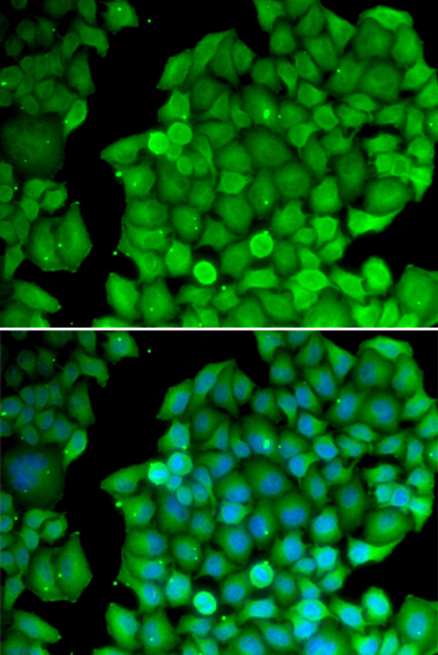 Immunofluorescence analysis of U2OS cells using Cyclin D2 antibody (14-888) . Blue: DAPI for nuclear staining.