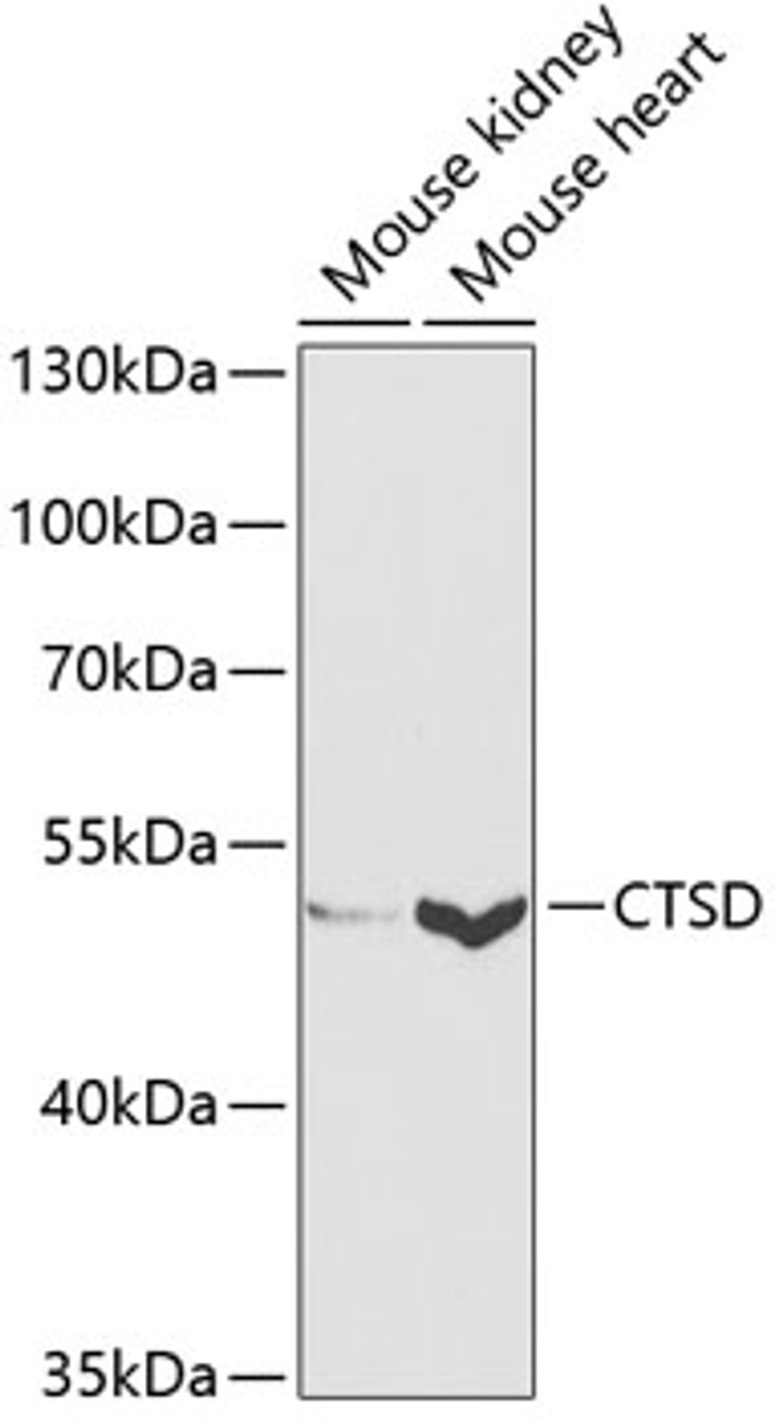 Western blot analysis of extracts of various cell lines, using CTSD antibody (14-893) at 1:1000 dilution.<br/>Secondary antibody: HRP Goat Anti-Rabbit IgG (H+L) at 1:10000 dilution.<br/>Lysates/proteins: 25ug per lane.<br/>Blocking buffer: 3% nonfat dry milk in TBST.