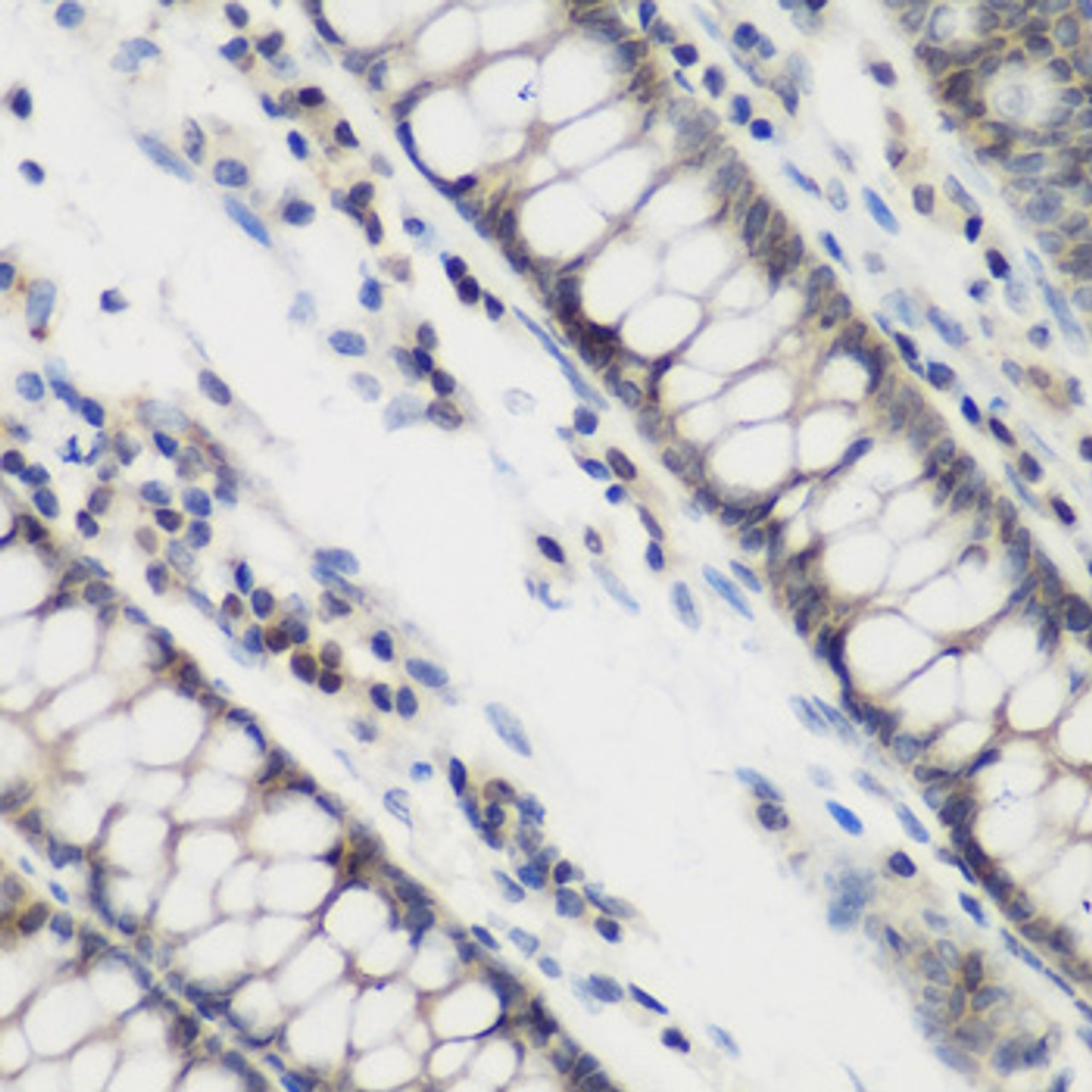 Immunohistochemistry of paraffin-embedded human colon using DHODH antibody (14-896) at dilution of 1:200 (40x lens) .