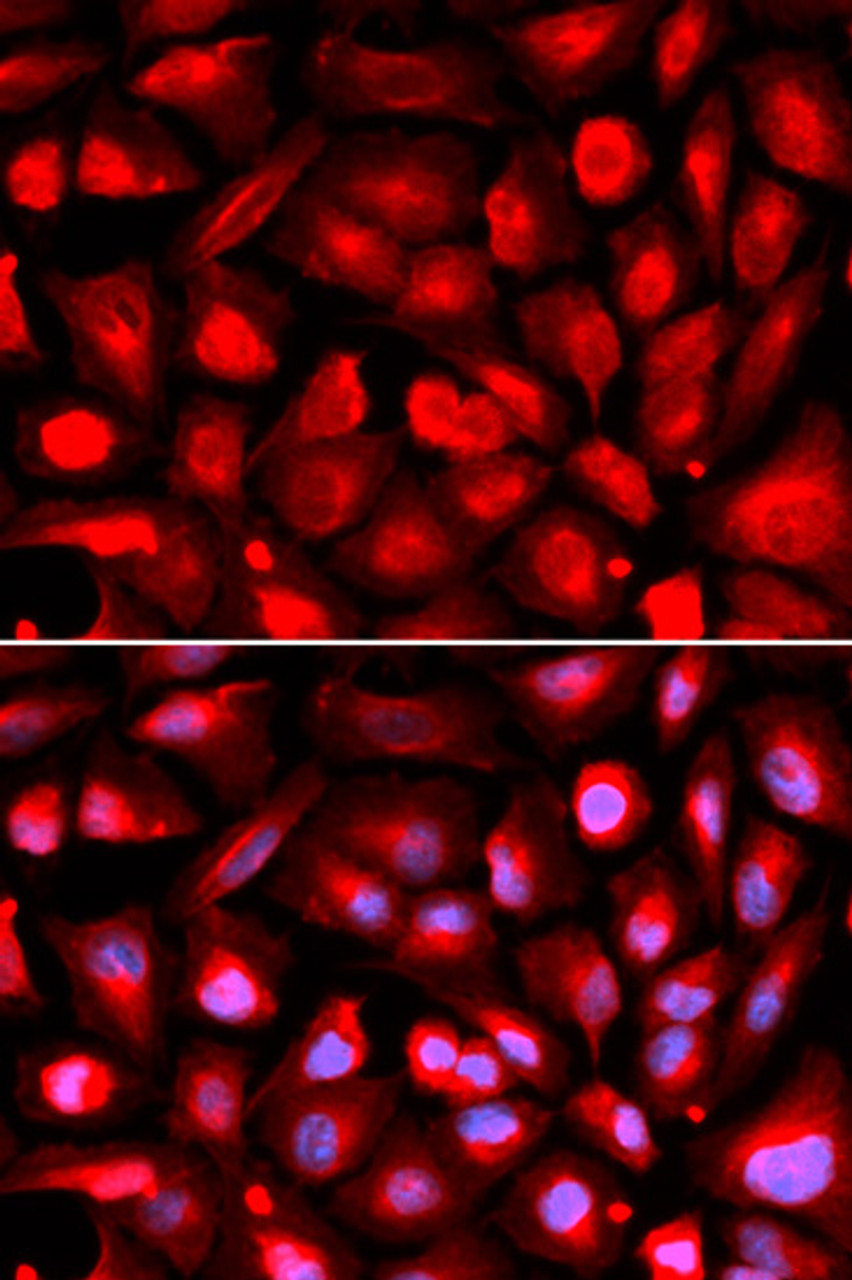 Immunofluorescence analysis of U2OS cells using ETS1 antibody (14-902) . Blue: DAPI for nuclear staining.