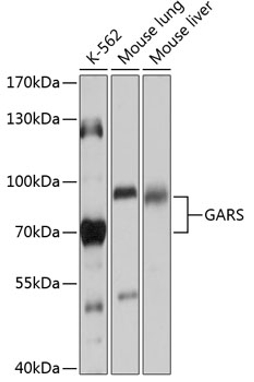 Western blot analysis of extracts of various cell lines, using GARS antibody (14-904) at 1:1000 dilution.<br/>Secondary antibody: HRP Goat Anti-Rabbit IgG (H+L) at 1:10000 dilution.<br/>Lysates/proteins: 25ug per lane.<br/>Blocking buffer: 3% nonfat dry milk in TBST.<br/>Detection: ECL Basic Kit.<br/>Exposure time: 5s.