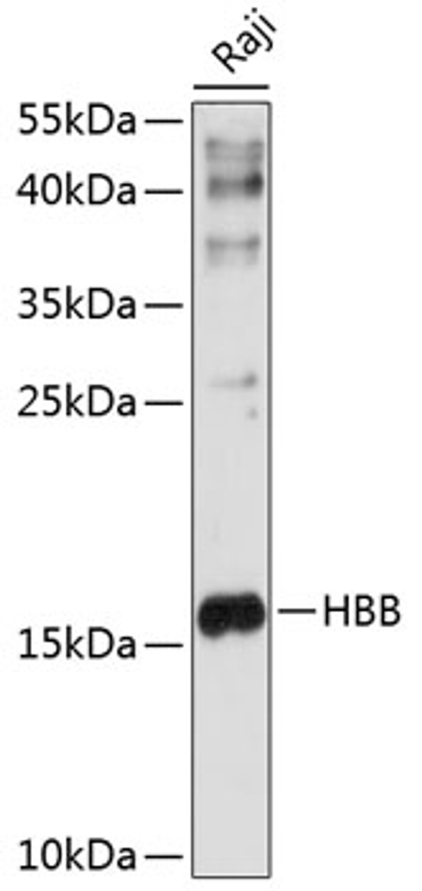 Western blot analysis of extracts of Raji cells, using HBB antibody (14-908) at 1:1000 dilution.<br/>Secondary antibody: HRP Goat Anti-Rabbit IgG (H+L) at 1:10000 dilution.<br/>Lysates/proteins: 25ug per lane.<br/>Blocking buffer: 3% nonfat dry milk in TBST.<br/>Detection: ECL Enhanced Kit.<br/>Exposure time: 10s.